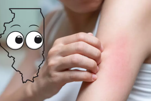 Beware: This Tiny Bug Could Cause a Rash Epidemic in Illinois