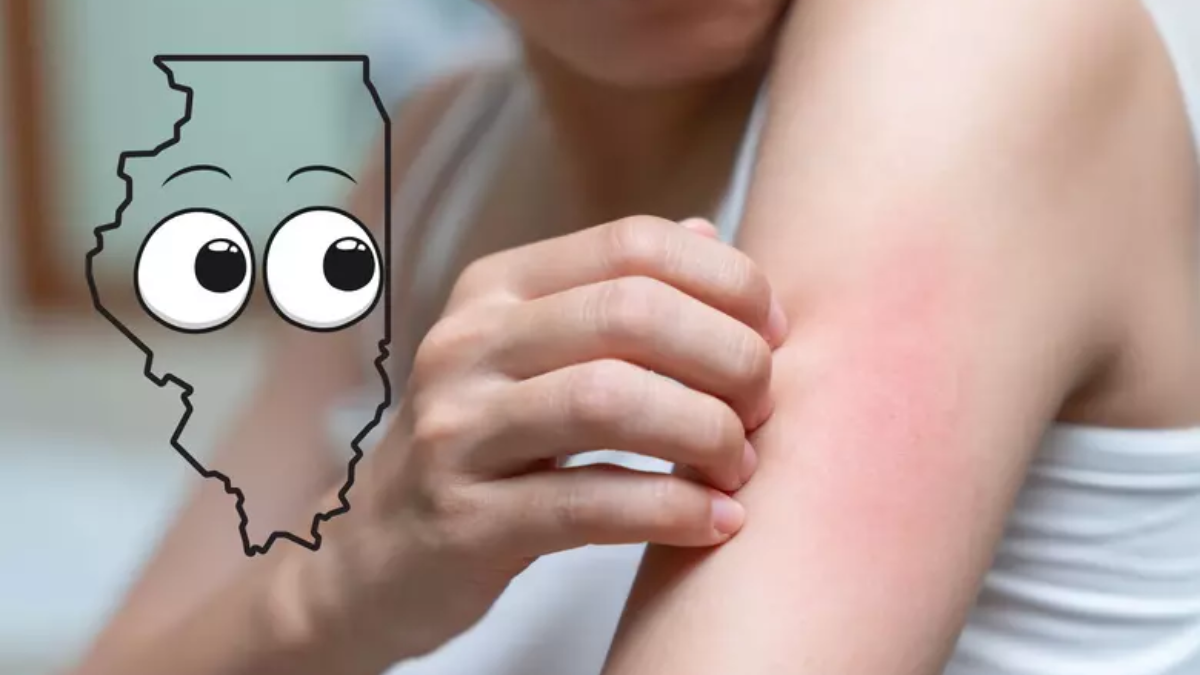 Beware: This Tiny Bug Could Cause a Rash Epidemic in Illinois